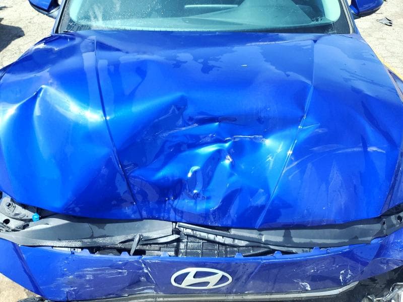 2025 HYUNDAI ELANTRA SE 11