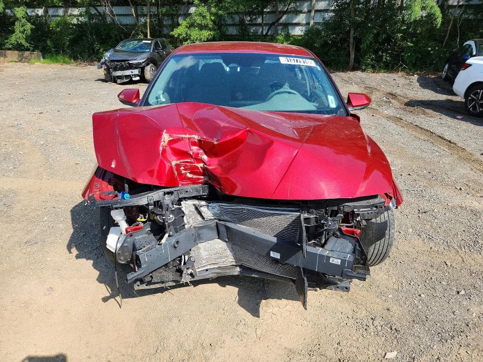 2024 HYUNDAI ELANTRA SEL 5
