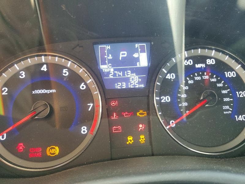 2017 HYUNDAI ACCENT SE 9