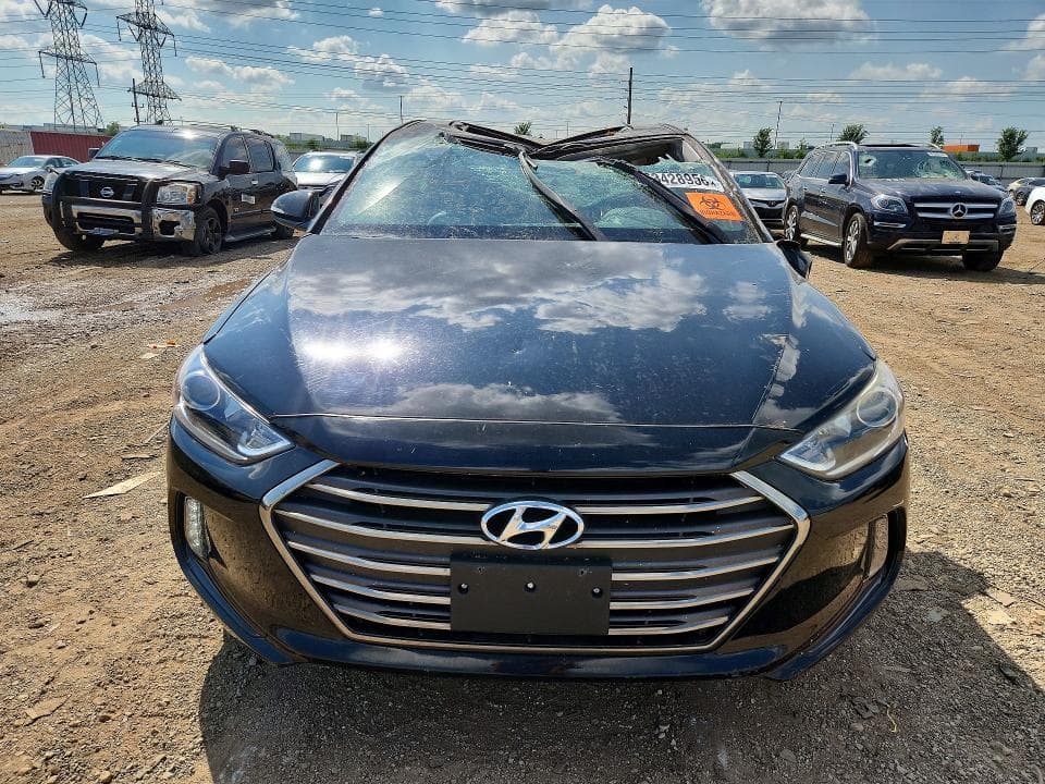 2017 HYUNDAI ELANTRA LIMITED 5