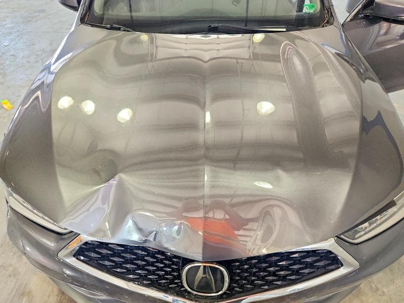2018 ACURA TLX TECH 11