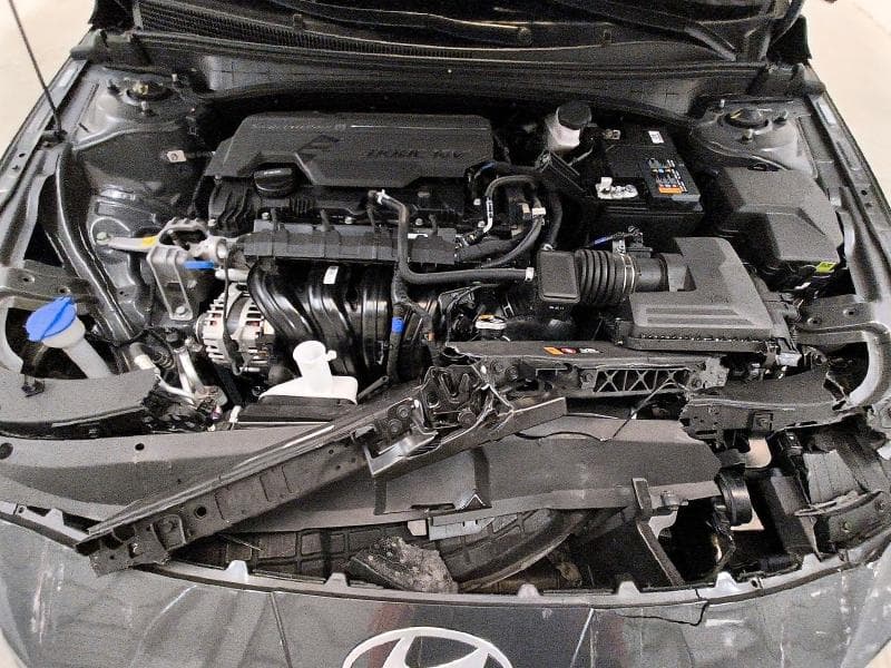 2025 HYUNDAI ELANTRA SEL SPORT SEL SPORT 11