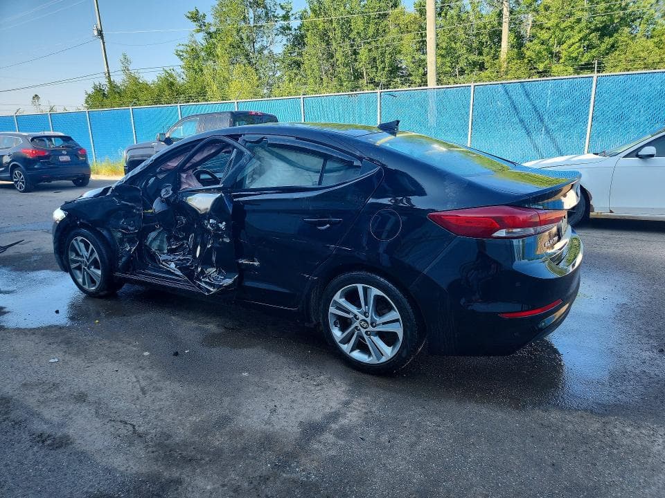 2017 HYUNDAI ELANTRA SE 2