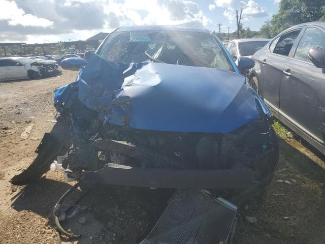 2017 HYUNDAI ELANTRA SE SE 5